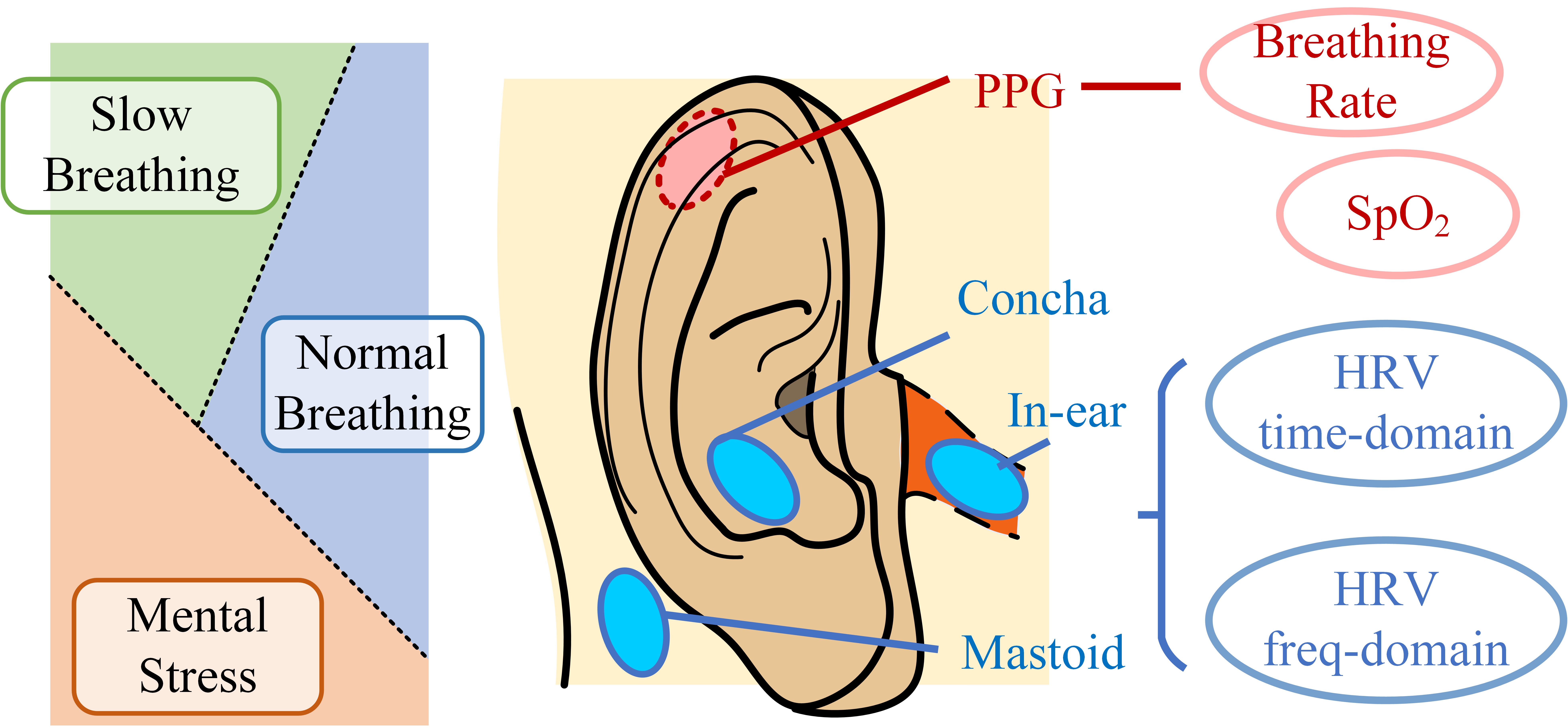 ECGSchematic